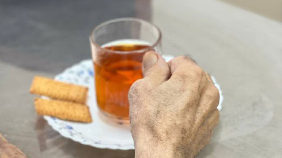 مشکل بی اختیاری در ادرار